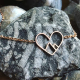 Heart Mountains Anklet